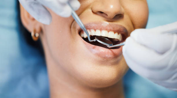Best Emergency Dentist for Lost Fillings or Crowns in Trenton, IL