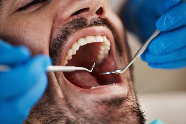 Best Emergency Dental Extractions in Trenton, IL